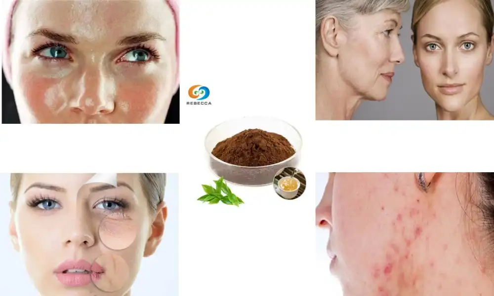 Discover the Power of Green Tea Extract for Skincare